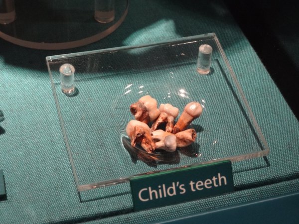 Child's teeth